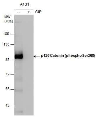 Western Blot: p120-catenin [p Ser268] Antibody [NBP3-12923]